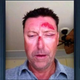 Illustration for article titled Robert Allenby Spent $3,400 At A Strip Club On Night Of Alleged Attack